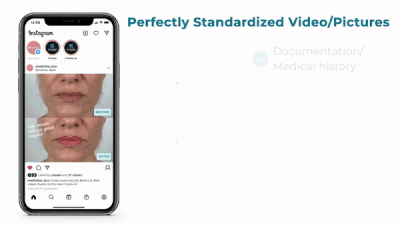 Your facial Before-and-Afters now perfectly standardized