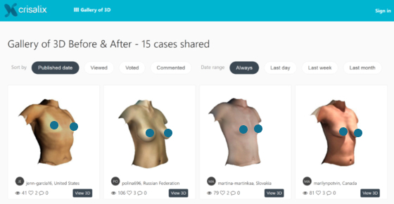 Before & After 3D Community